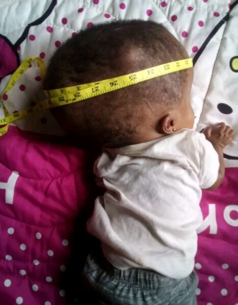 Maryam head circumference measurement