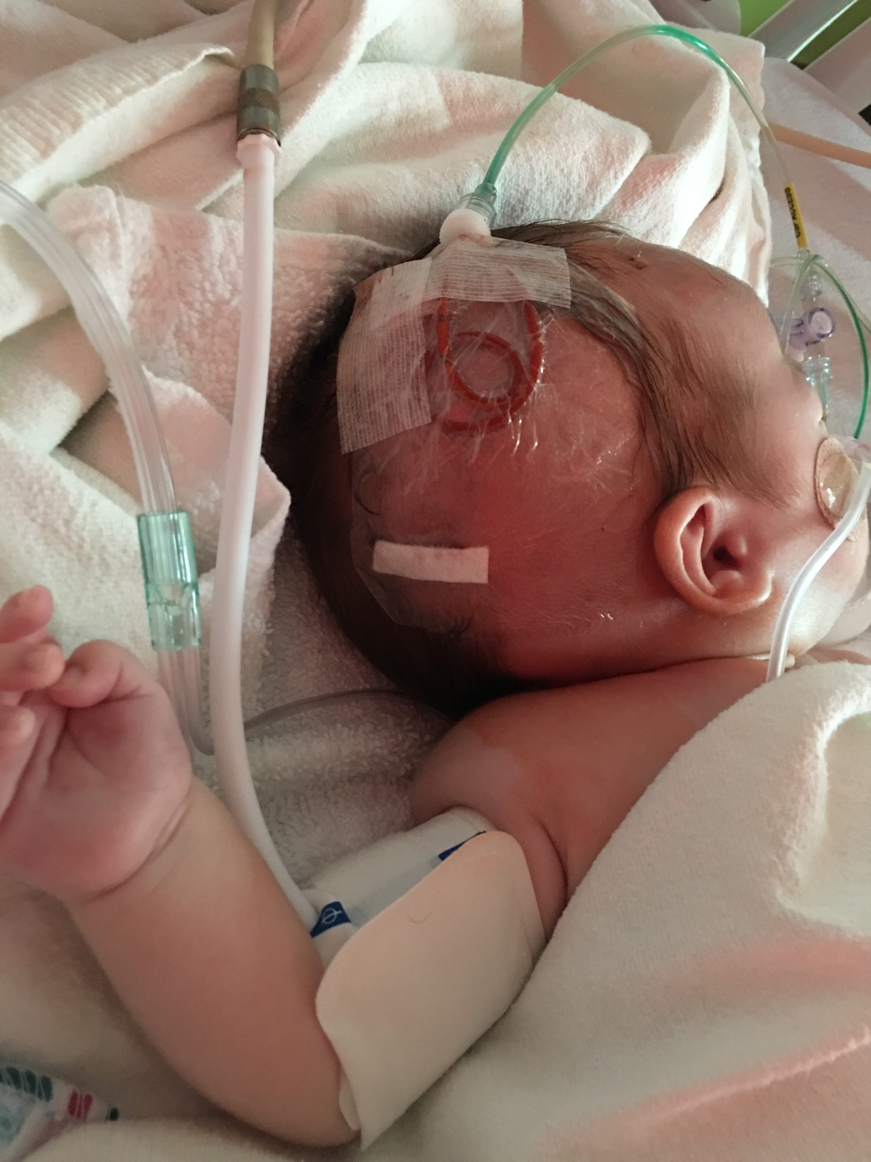 Draining during infection