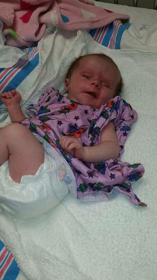 Blythe Day she was admitted and diagnosed. Night before surgery.