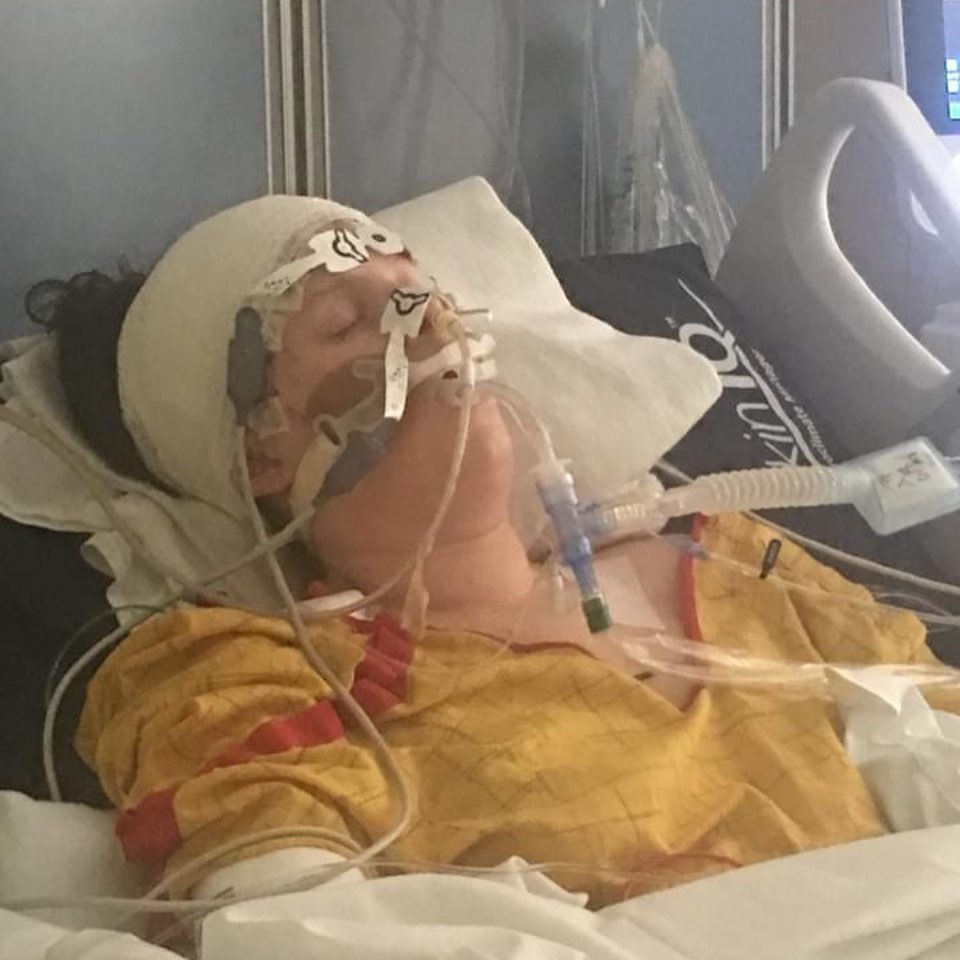 Courtney Roberge Hydrocephalus 3