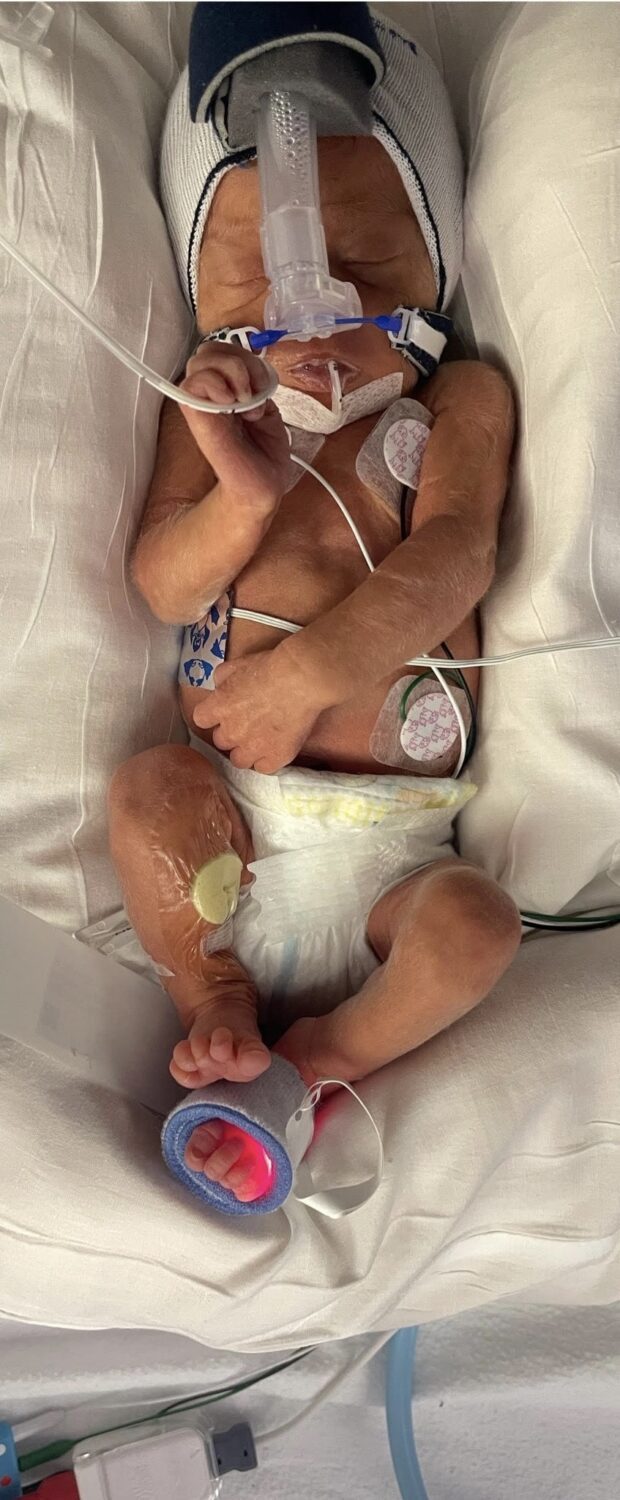 EE0476ED 855C 4556 AB74 E84868FD7C39 1 201 a 2