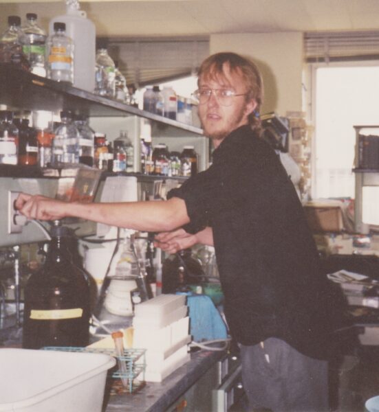 James, Hydrocephalus Patient