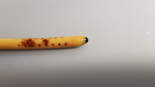 Occluded shunt Sample 3