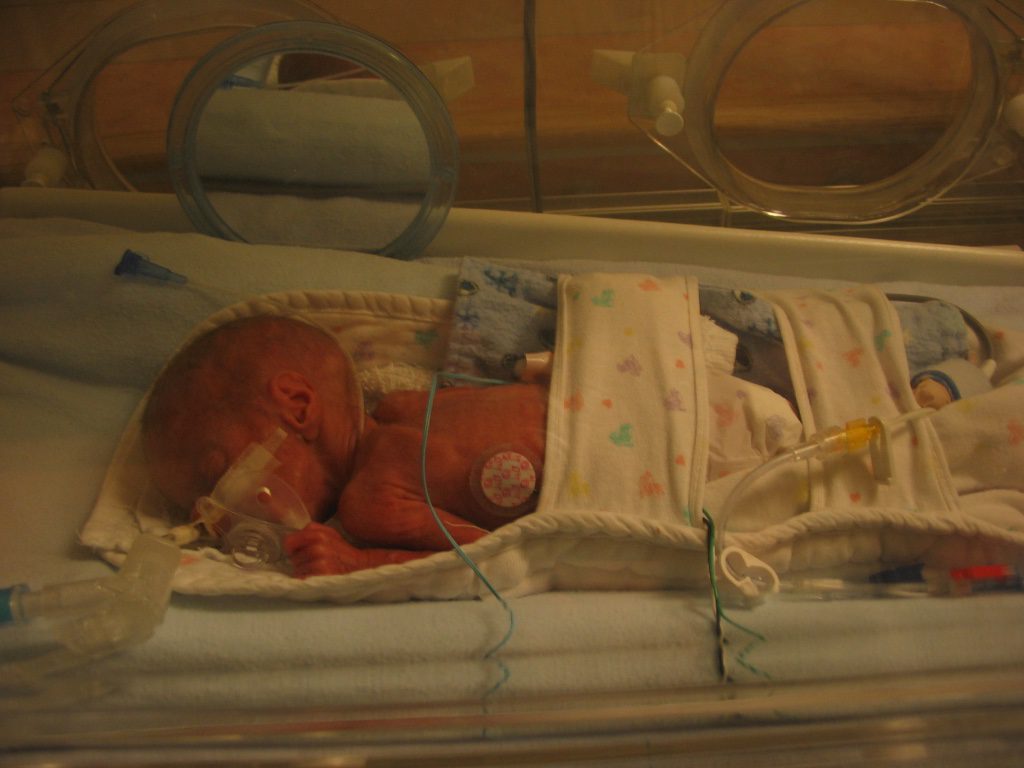 Charlie - 3 Weeks old