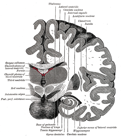 DTI image brain