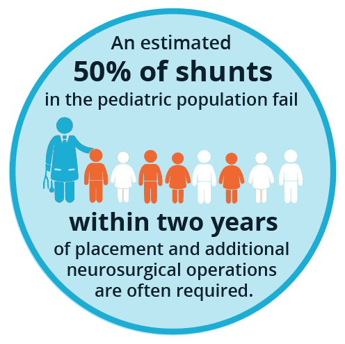 shunt, pediatric, complications, shunt system