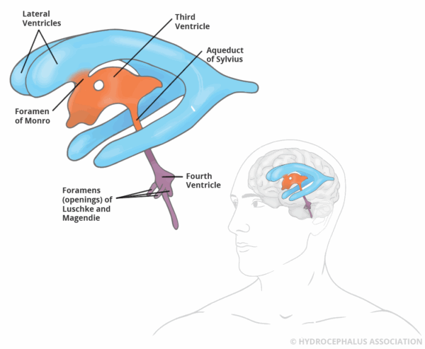 HA Ventricle diagramlabels web