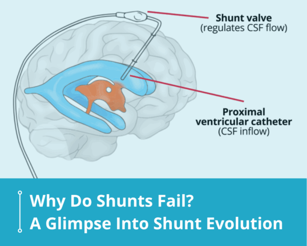 Shunt Evolution Blog Feature Image